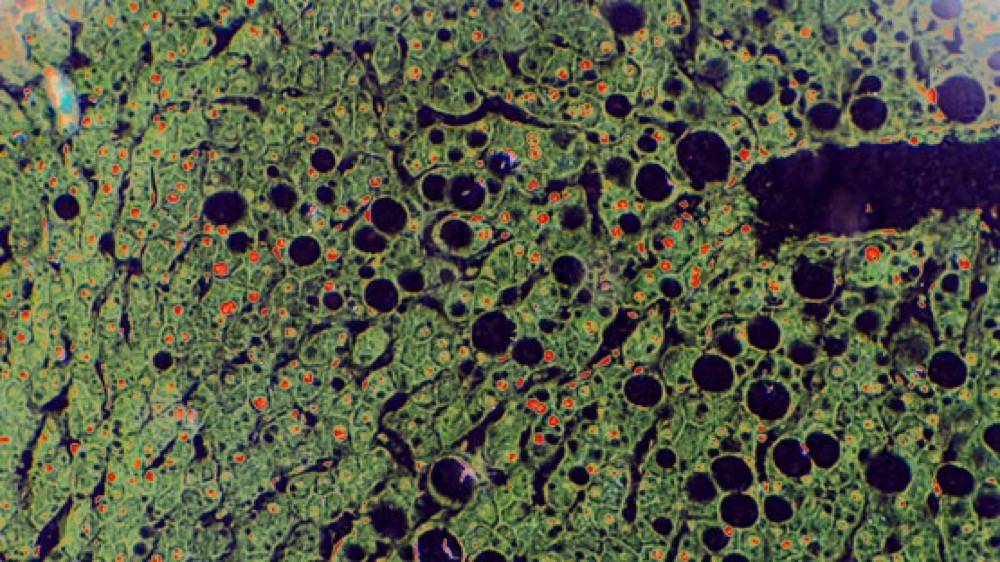 GLYPHOSATE JUICE YEAH OK