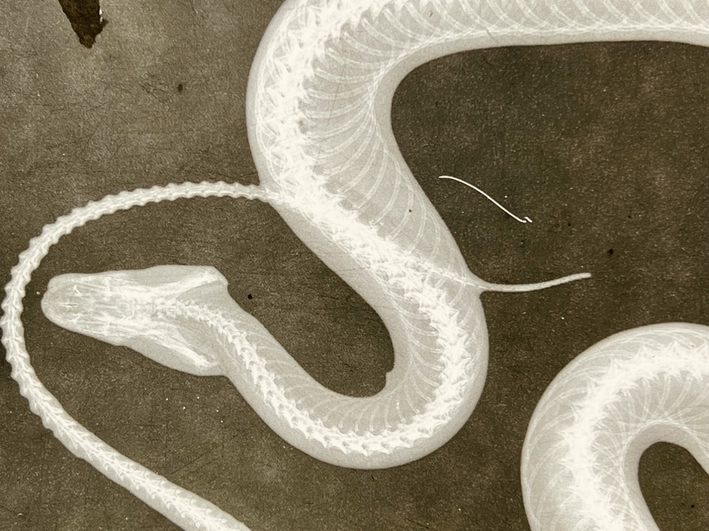 UNCOMFORTABLE GLUCOSAMINE