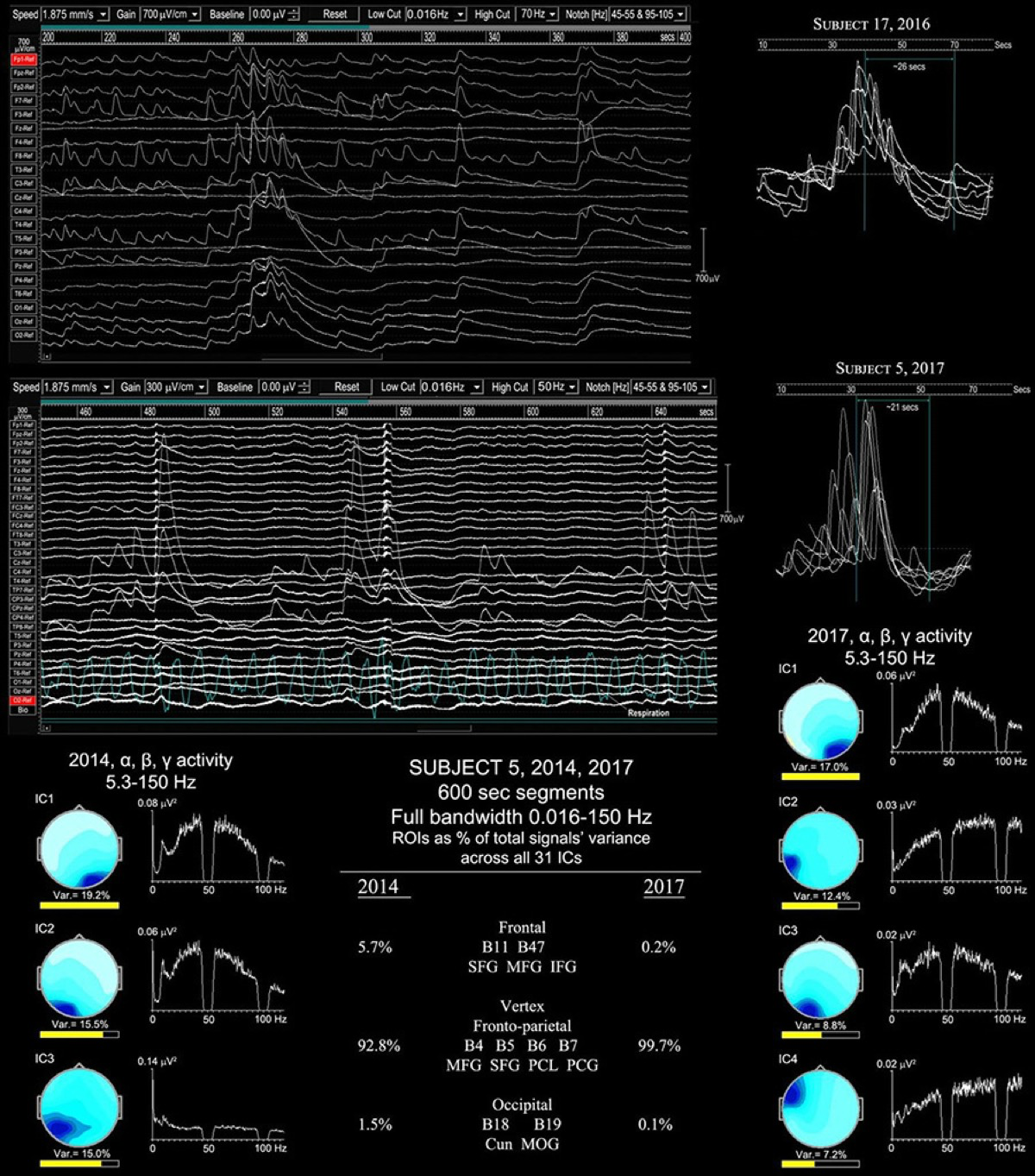 CORTEX SUPERVISOR 76