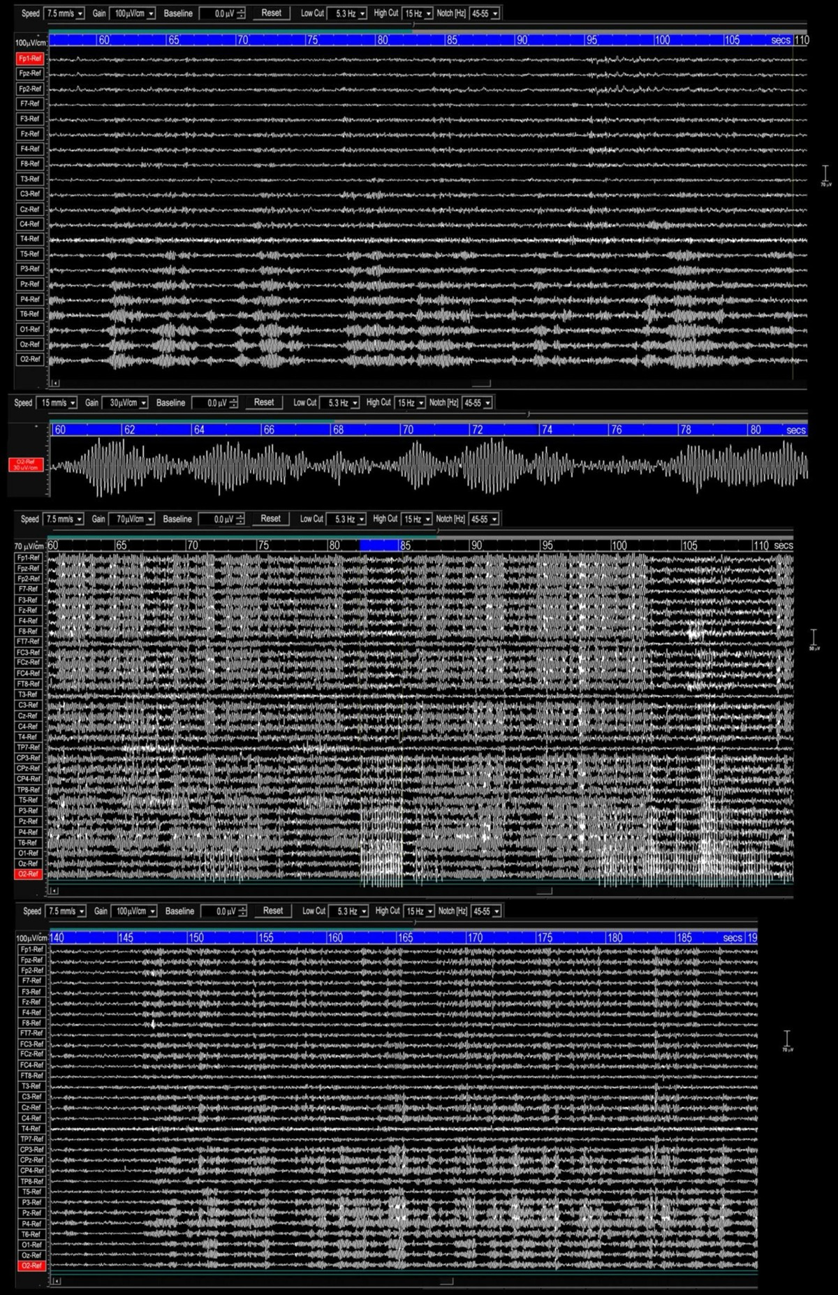 MULTITASK ANALYSIS BIZROD